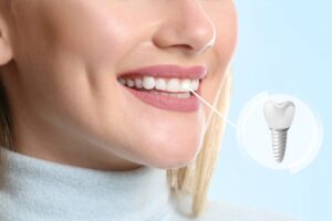 Woman smiling with a high-quality dental implant